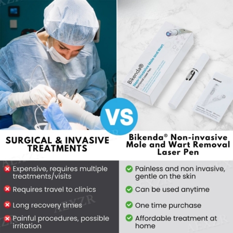 Non-Invasive Mole and Wart Removal Laser Pen image Non-Invasive Mole and Wart Removal Laser Pen